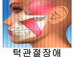턱관절장애
